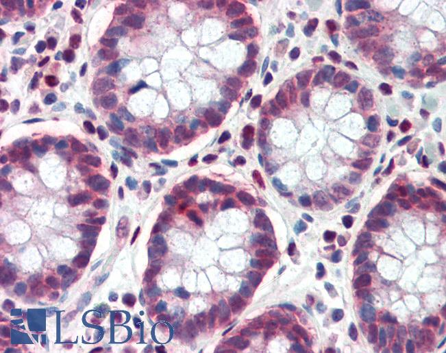 Anti-TCF7L1 antibody IHC of human colon. Immunohistochemistry of formalin-fixed, paraffin-embedded tissue after heat-induced antigen retrieval. Antibody LS-B3476 concentration 5 ug/ml.