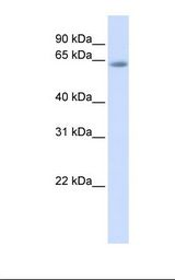 Fetal muscle lysate. Antibody concentration: 1.0 ug/ml. Gel concentration: 12%.