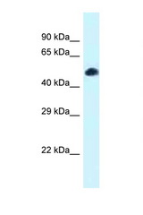 TCF7L2 antibody LS-C145594 Western blot of Mouse Spleen lysate. Antibody concentration 1 ug/ml.