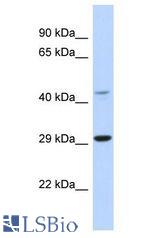 TCFL5 antibody Western Blot of Mouse Spleen. Antibody dilution: 1 ug/ml.