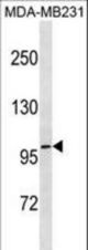 TCHHL1 Antibody western blot of MDA-MB231 cell line lysates (35 ug/lane). The TCHHL1 antibody detected the TCHHL1 protein (arrow).