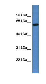 TCHP antibody LS-C135812 Western blot of Fetal Liver lysate.