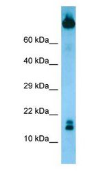 TCL1B antibody Western Blot of MCF7 cell lysate.