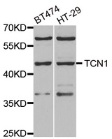 Western blot analysis of extracts of various cell lines, using TCN1 antibody.