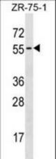 TCN1 Antibody western blot of ZR-75-1 cell line lysates (35 ug/lane). The TCN1 antibody detected the TCN1 protein (arrow).