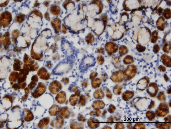 Immunoperoxidase of monoclonal antibody to TCN1 on formalin-fixed paraffin-embedded human salivary gland. [antibody concentration 3 ug/ml]