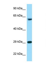 TCP1 antibody LS-C146196 Western blot of HeLa Cell lysate. Antibody concentration 1 ug/ml.