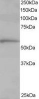 TCP1 antibody staining (1 ug/ml) of Human Lung lysate (RIPA buffer, 35g total protein per lane). Primary incubated for 1 hour. Detected by Western blot of chemiluminescence.