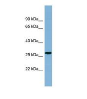 Western blot of Human THP-1. TCP10 antibody dilution 1.0 ug/ml.