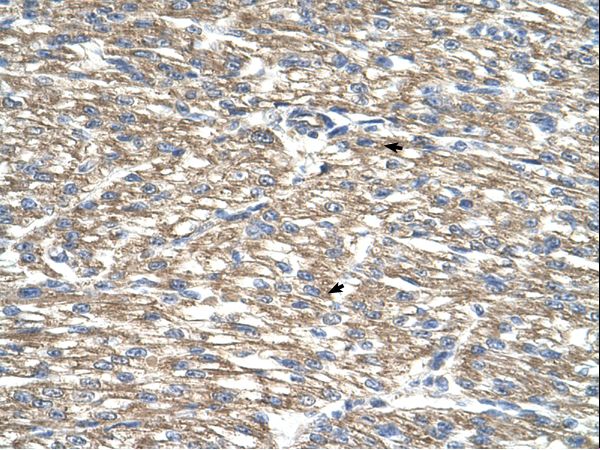 TCP10 antibody LS-C80784 was used in IHC to stain formalin-fixed, paraffin-embedded human heart.
