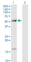 Western Blot analysis of TCP11 expression in transfected 293T cell line by TCP11 monoclonal antibody (M07), clone 2E3.Lane 1: TCP11 transfected lysate (Predicted MW: 49.3 KDa).Lane 2: Non-transfected lysate.