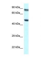 PUS1 antibody LS-C145514 Western blot of Jurkat Cell lysate. Antibody concentration 1 ug/ml.