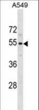 PUS10 Antibody western blot of A549 cell line lysates (35 ug/lane). The PUS10 antibody detected the PUS10 protein (arrow).