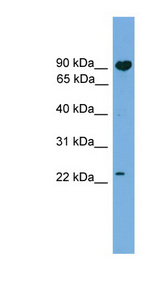 TCTEX1D4 antibody LS-C116579 Western blot of 721_B cell lysate.