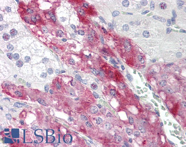 Anti-TCTEX1D4 antibody IHC staining of human adrenal. Immunohistochemistry of formalin-fixed, paraffin-embedded tissue after heat-induced antigen retrieval.