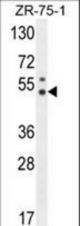 PUS3 Antibody western blot of ZR-75-1 cell line lysates (35 ug/lane). The PUS3 antibody detected the PUS3 protein (arrow).