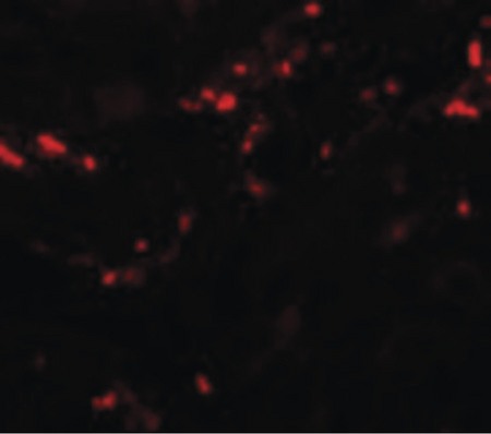 Immunofluorescence of TCTN1 in Human Kidney cells with TCTN1 antibody at 20 ug/ml.