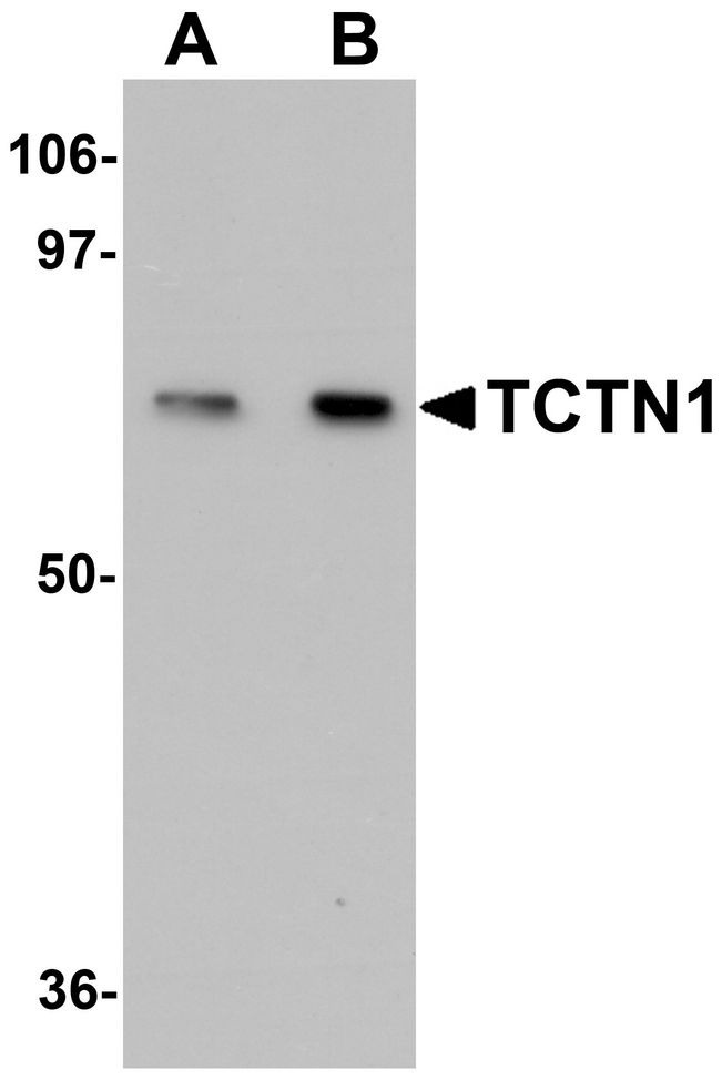 Western blot analysis of TCTN1 in mouse kidney tissue lysate with TCTN1 antibody at (A) 1 and (B) 2ug/ml.