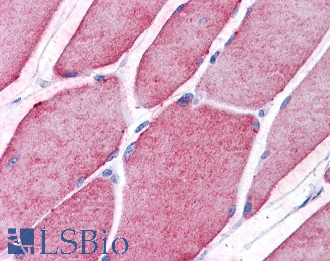 Anti-TCTN2 antibody IHC of human skeletal muscle. Immunohistochemistry of formalin-fixed, paraffin-embedded tissue after heat-induced antigen retrieval. Antibody LS-B5305 concentration 5 ug/ml.