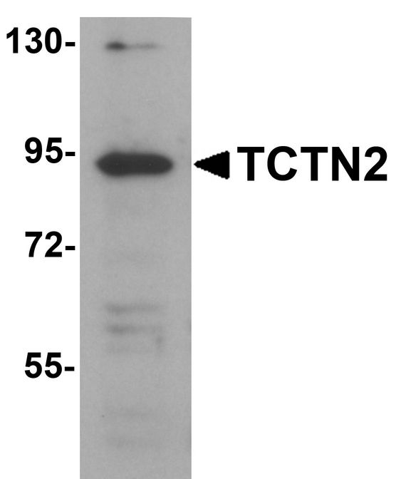 Western blot analysis of TCTN2 in SK-N-SH cell lysate with TCTN2 antibody at 1 ug/ml.