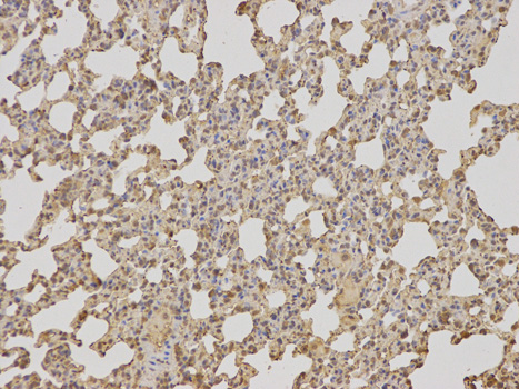 Immunohistochemistry of paraffin-embedded rat lung using TCTN3 antibody at dilution of 1:100 (200x lens).