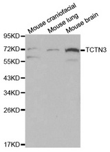 Western blot analysis of various cell lines using TCTN3 antibody.