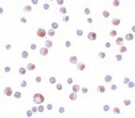 Immunocytochemistry of TCTN3 in HeLa cells with TCTN3 antibody at 4 ug/ml.