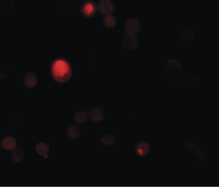 Immunofluorescence of TCTN3 in HeLa cells with TCTN3 antibody at 20 ug/ml.
