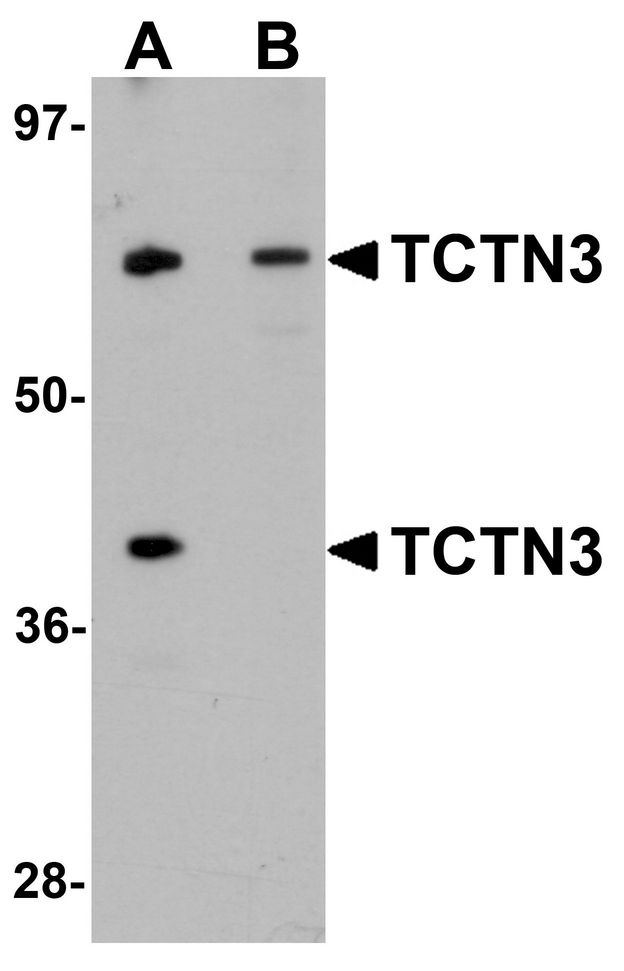 Western blot analysis of TCTN3 in HeLa cell lysate with TCTN3 antibody at (A) 1 and (B) 2ug/ml.