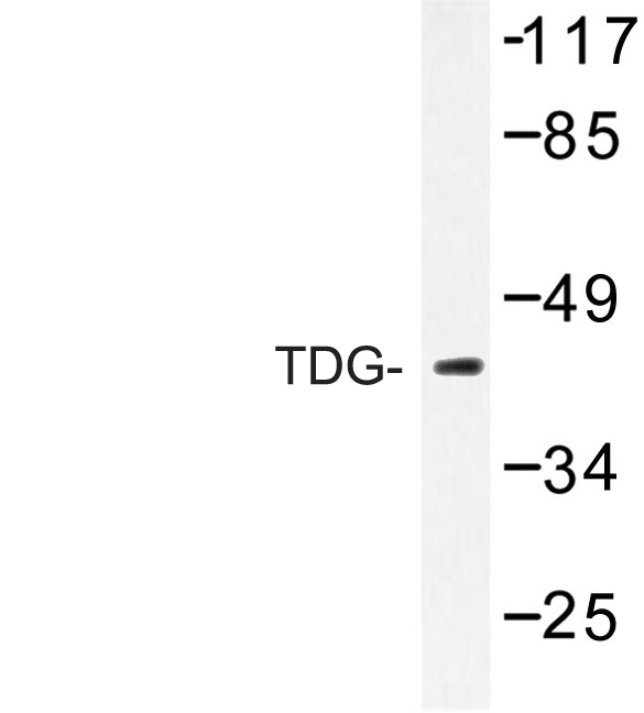 Western blot of TDG (K90) pAb in extracts from Jurkat cells.