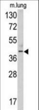 Western blot of TDG antibody in mouse lung tissue lysates (35 ug/lane). TDG (arrow) was detected using the purified antibody.