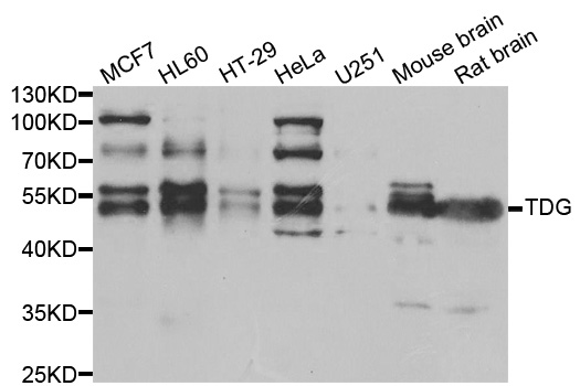 Western blot analysis of extracts of various cell lines, using TDG antibody.