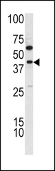 Western blot of TDG antibody in K562 cell line lysates (35 ug/lane). TDG (arrow) was detected using the purified antibody.