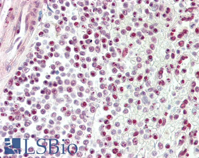 Anti-TDP-43 / TARDBP antibody IHC staining of human spleen. Immunohistochemistry of formalin-fixed, paraffin-embedded tissue after heat-induced antigen retrieval.