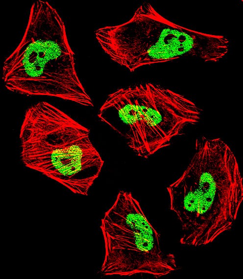 Fluorescent confocal image of HeLa cell stained with TARDBP Antibody. HeLa cells were fixed with 4% PFA (20 min), permeabilized with Triton X-100 (0.1%, 10 min), then incubated with TARDBP primary antibody (1:25, 1 h at 37°C). For secondary antibody, Alexa Fluor 488 conjugated donkey anti-rabbit antibody (green) was used (1:400, 50 min at 37°C). Cytoplasmic actin was counterstained with Alexa Fluor 555 (red) conjugated Phalloidin (7units/ml, 1 h at 37°C). Nuclei were counterstained with DAPI (blue) (10 ug/ml, 10 min). TARDBP immunoreactivity is localized to nucleus significantly and Cytoplasm weakly.