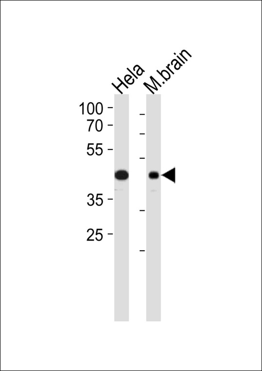 TARDBP Antibody western blot of HeLa cell line and mouse brain lysates (35 ug/lane). The TARDBP antibody detected the TARDBP protein (arrow).