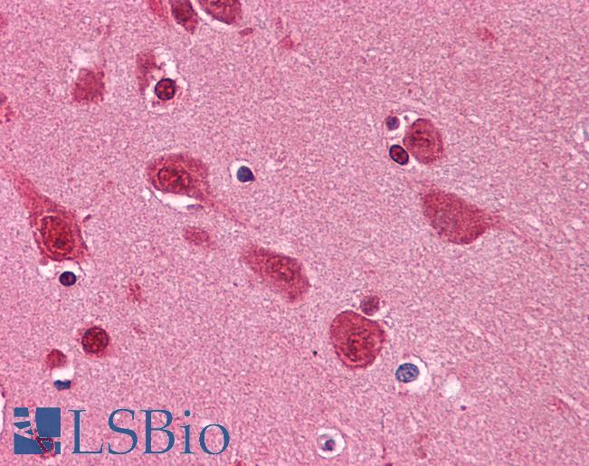 Anti-TARDBP antibody IHC of human brain, cortex. Immunohistochemistry of formalin-fixed, paraffin-embedded tissue after heat-induced antigen retrieval. Antibody LS-B4521 concentration 5 ug/ml.
