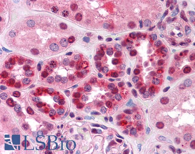 Anti-TARDBP antibody IHC of human kidney. Immunohistochemistry of formalin-fixed, paraffin-embedded tissue after heat-induced antigen retrieval. Antibody LS-B4521 concentration 5 ug/ml.