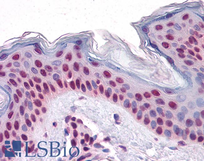 Anti-TARDBP antibody IHC of human skin. Immunohistochemistry of formalin-fixed, paraffin-embedded tissue after heat-induced antigen retrieval. Antibody LS-B4521 concentration 5 ug/ml.