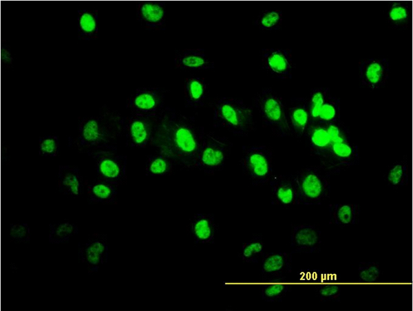 Immunofluorescence of monoclonal antibody to TARDBP on HeLa cell (antibody concentration 10 ug/ml).