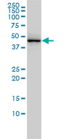 TARDBP monoclonal antibody clone 2E2-D3 Western blot of TARDBP expression in A-431.
