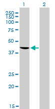 Western blot of TARDBP expression in transfected 293T cell line by TARDBP monoclonal antibody clone 2E2-D3.