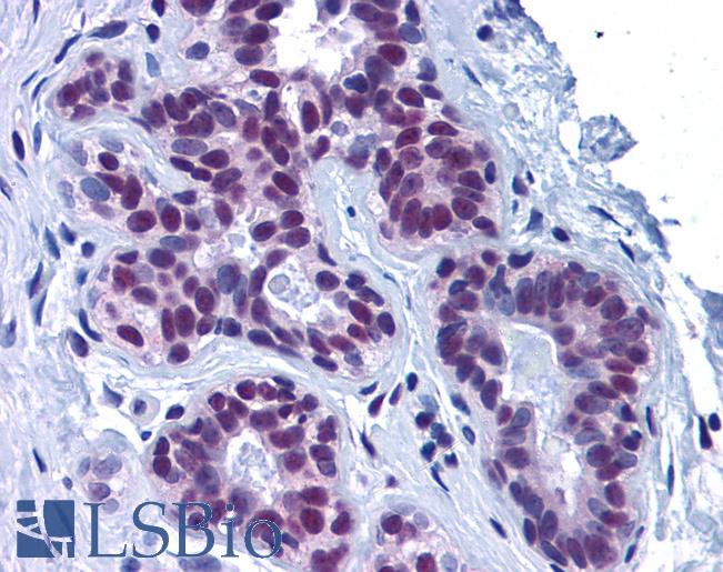Anti-TARDBP antibody IHC of human breast. Immunohistochemistry of formalin-fixed, paraffin-embedded tissue after heat-induced antigen retrieval. Antibody LS-B4917 concentration 10 ug/ml.