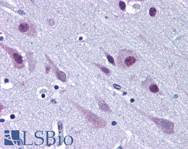 Anti-TARDBP antibody IHC of human brain, cortex. Immunohistochemistry of formalin-fixed, paraffin-embedded tissue after heat-induced antigen retrieval. Antibody LS-B4917 concentration 10 ug/ml.
