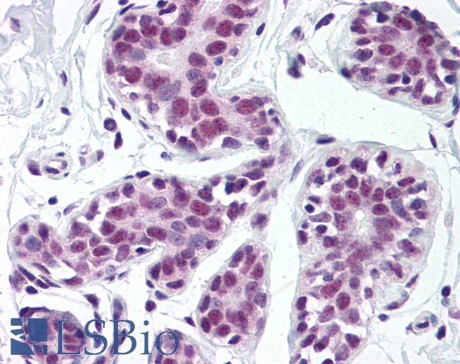 Anti-TARDBP antibody IHC of human breast. Immunohistochemistry of formalin-fixed, paraffin-embedded tissue after heat-induced antigen retrieval. Antibody LS-B2223 concentration 5 ug/ml.