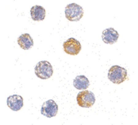 Immunocytochemistry of TDP43 in HeLa cells with TDP43 antibody at 5 ug/ml.