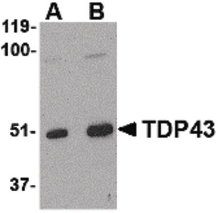 Western blot of TDP43 in L1210 cell lysate with TDP43 antibody at (A) 0.5, (B) 1 and (C) 2 ug/ml.