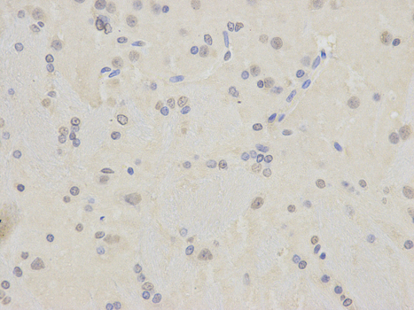 Immunohistochemistry of paraffin-embedded rat brain lung using TARDBP antibody at dilution of 1:200 (400x lens).
