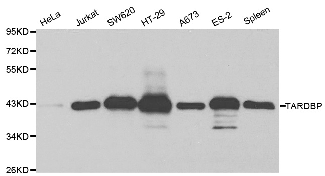 Western blot analysis of extracts of various cell lines, using TARDBP antibody.