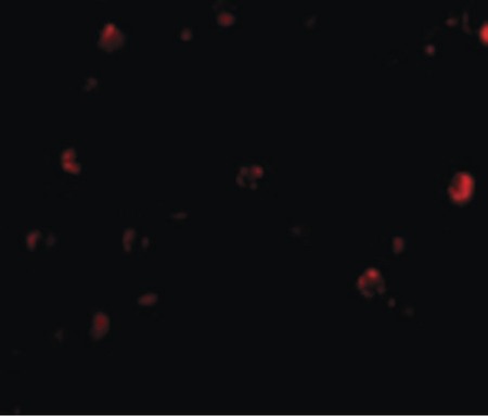 Immunofluorescence of TDP43 in HeLa cells with TDP43 antibody at 20 ug/ml.